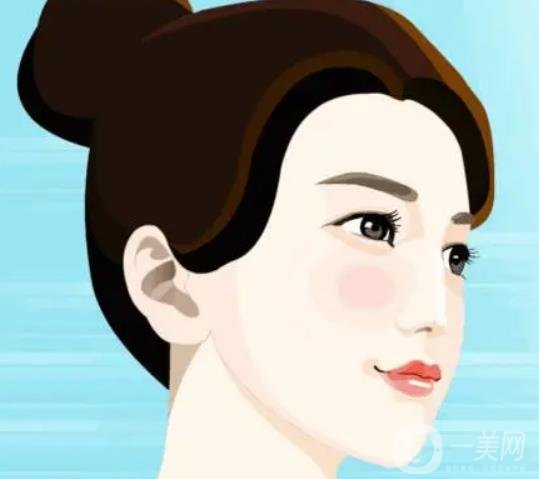 假體下巴多久恢復？恢復過程怎樣的？